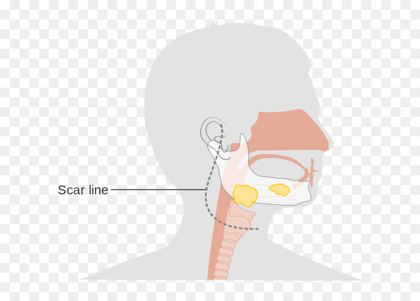 Illustration, HD Png Download - sweating png