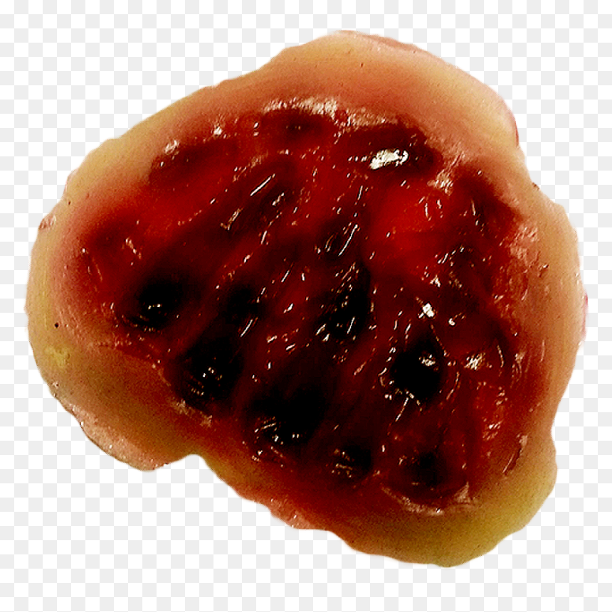 Seedless Fruit, HD Png Download - scar png