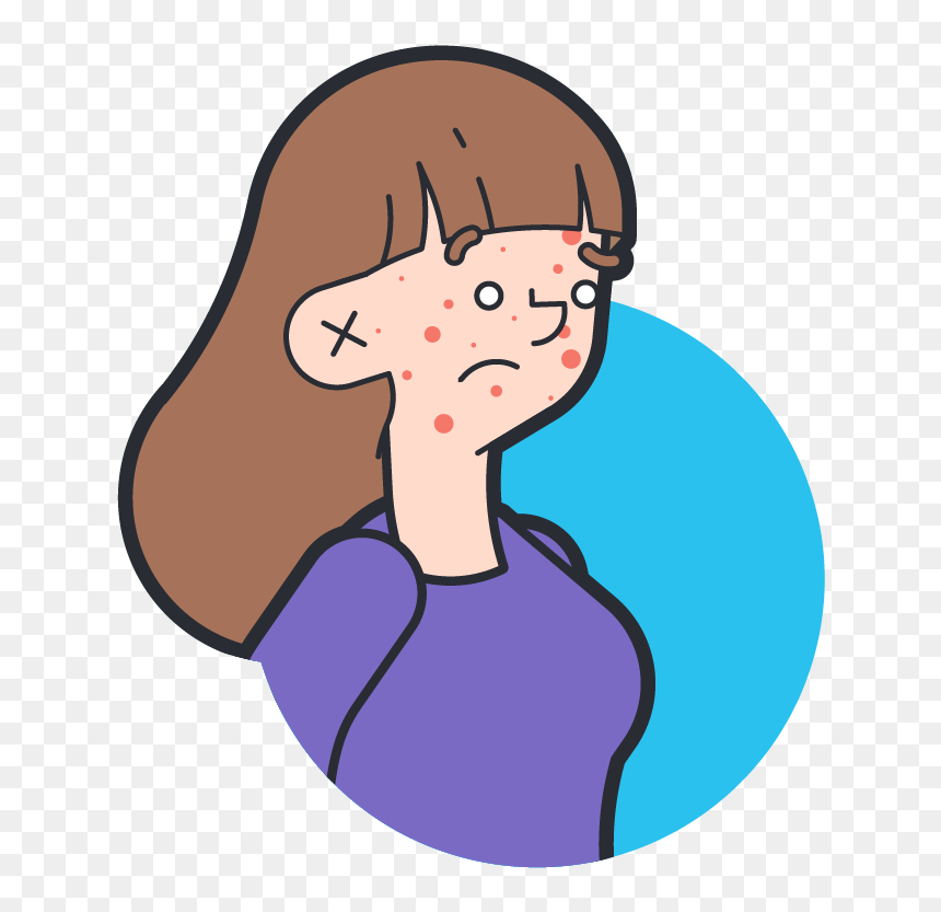 Acne Treatments, HD Png Download - pimple png