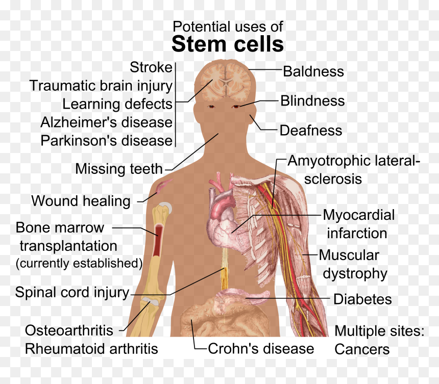 Stem Cell Treatments - Potential Uses Of Stem Cells, HD Png Download - injury png