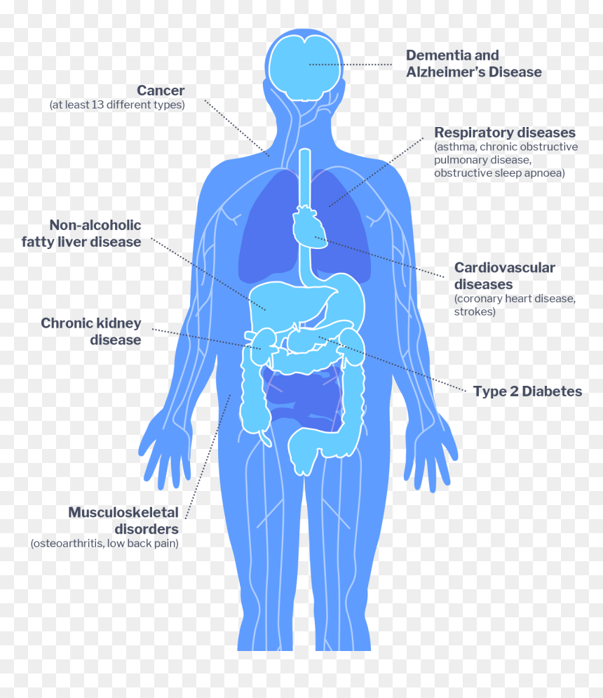 Obesity Impacts, HD Png Download - obesity png