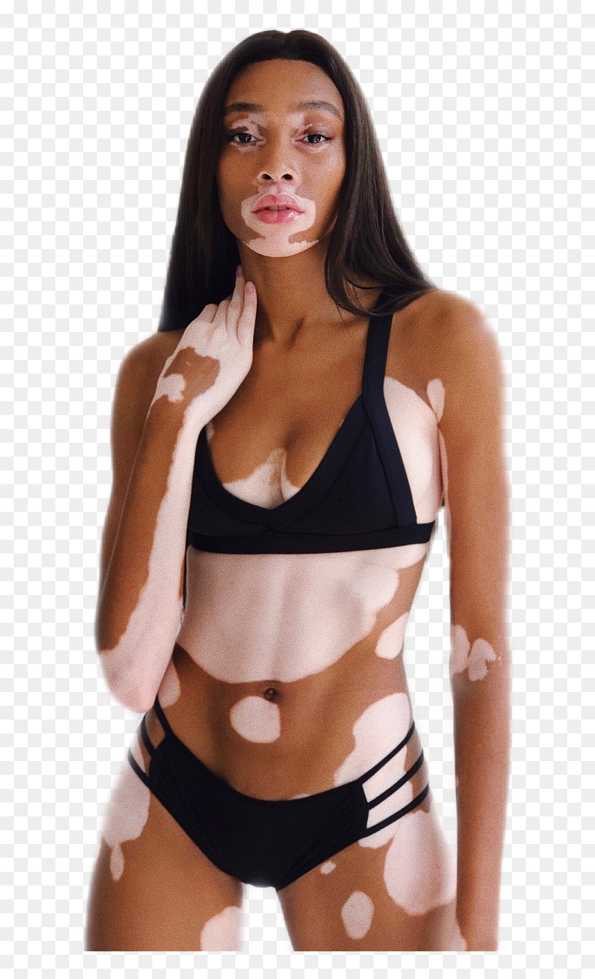 #beauty #model #winnieharlow #modeling #bikini #swimsuit - Whitney Harlow, HD Png Download - swimsuit model png