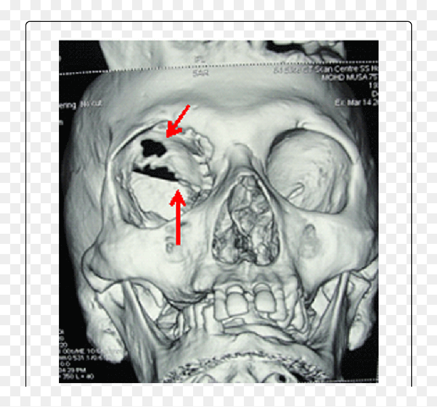Skull, HD Png Download - red right arrow png