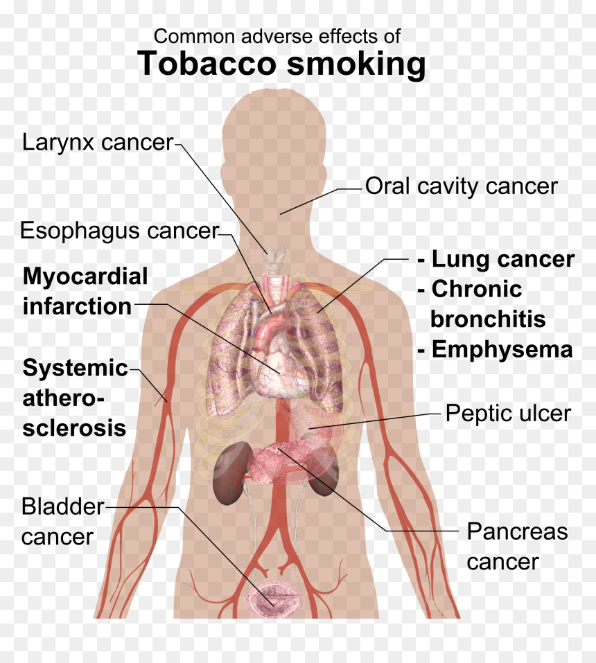 Common Adverse Effects Of Tobacco Smoking, HD Png Download - png effects