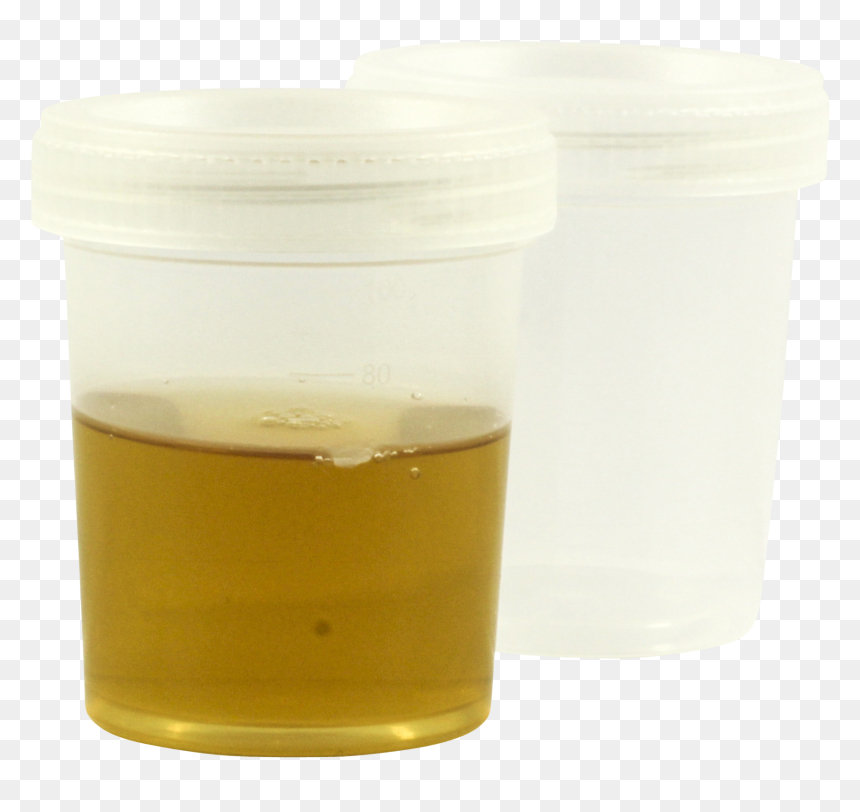 Lager, HD Png Download - test tubes png