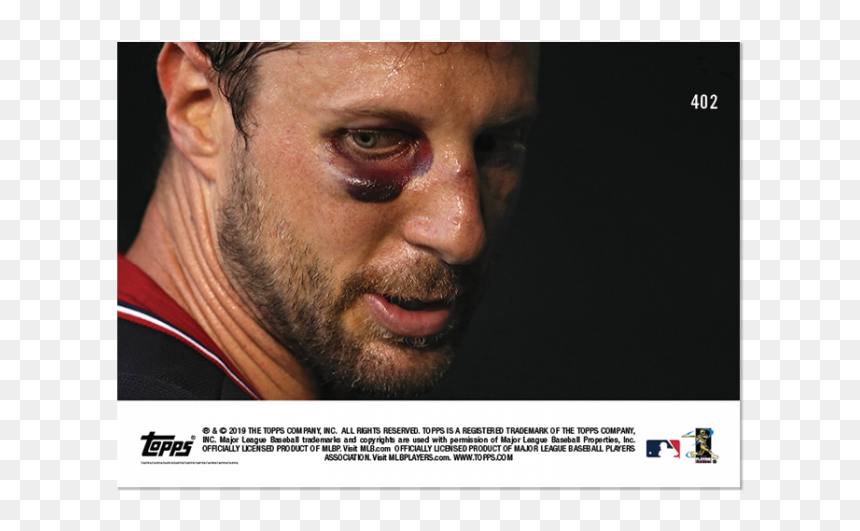 Max Scherzer Broken Nose, HD Png Download - ethan klein png
