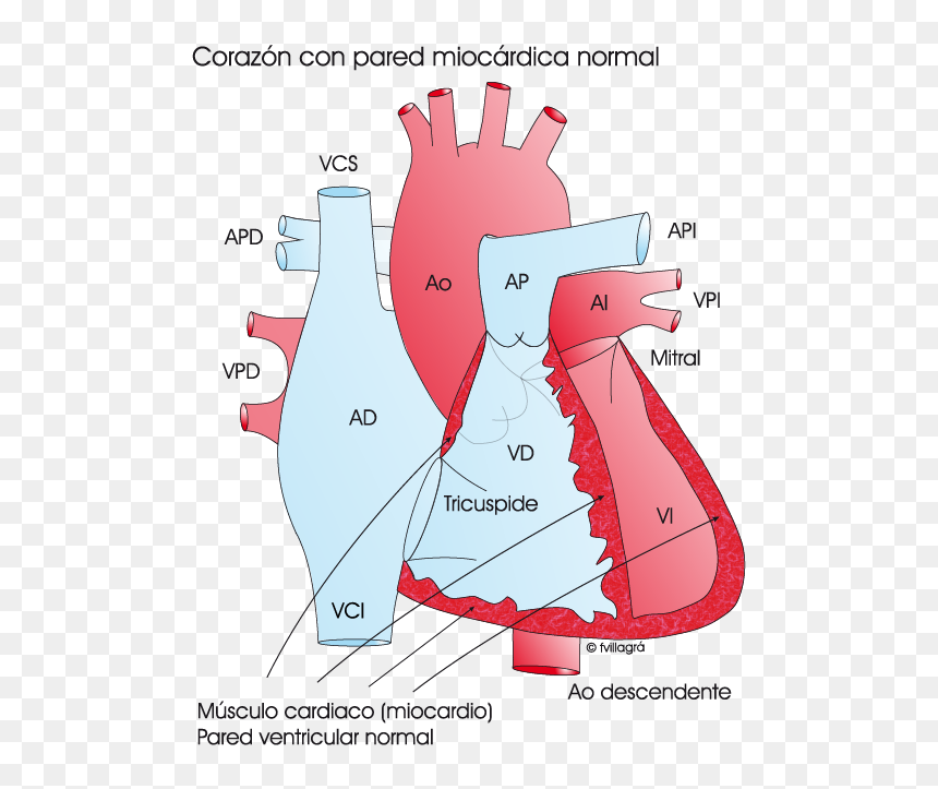 Tetralogia De Fallot Cirugia, HD Png Download - niños jugando png