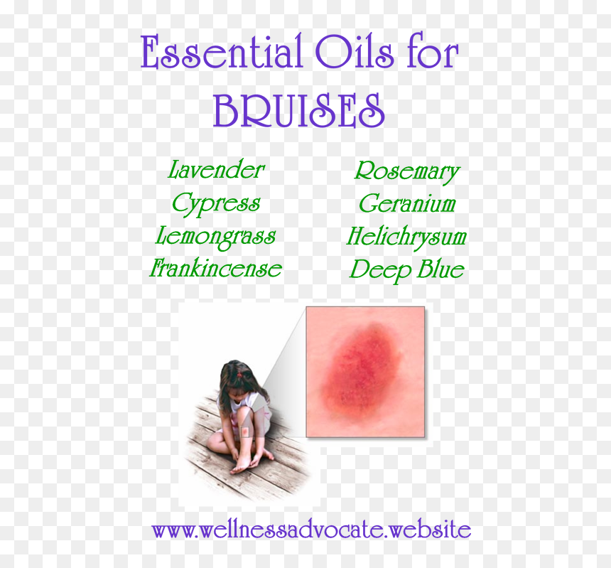Picture - Essential Oil For Bruise, HD Png Download - bruises png