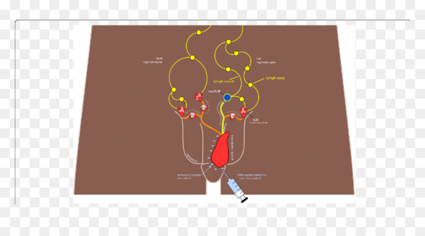 Graphic Design, HD Png Download - tracer png