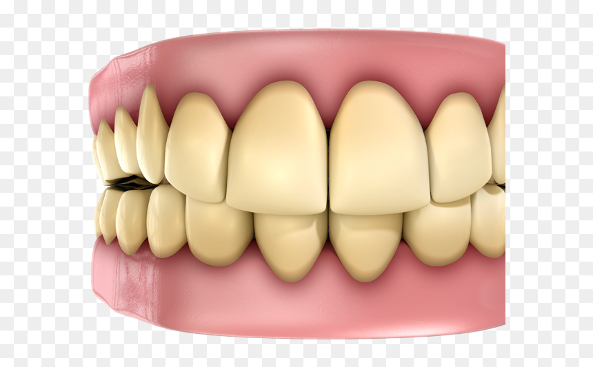 Fact And Myth About Health, HD Png Download - teeth.png