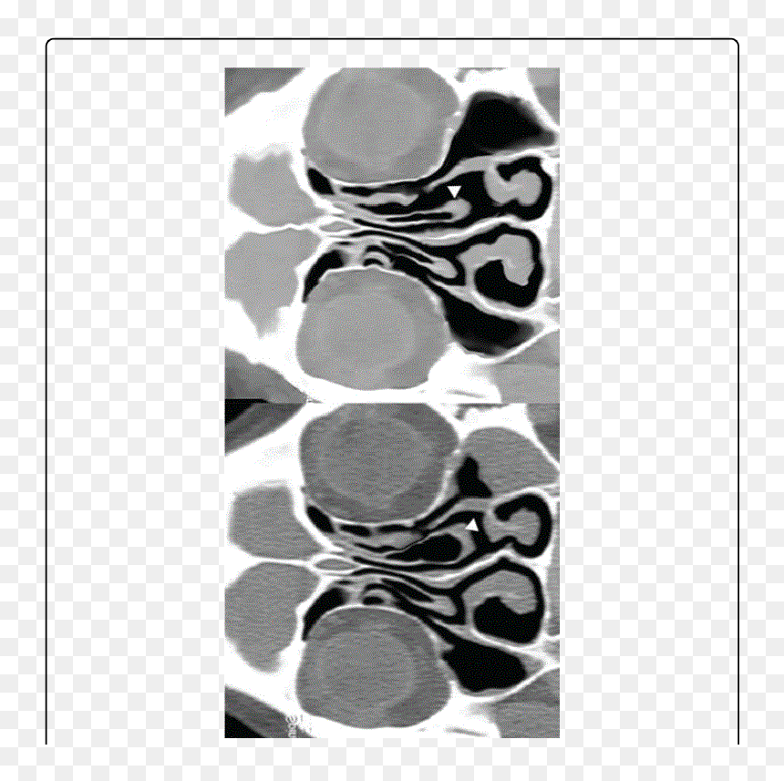 Monochrome, HD Png Download - concha png