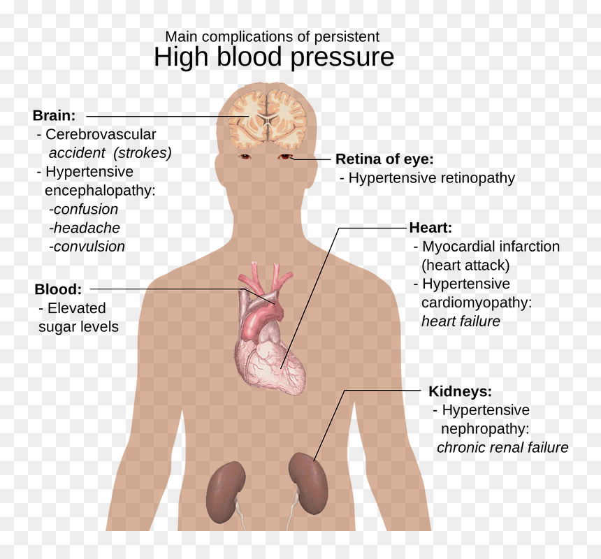 High Blood Pressure Diabetes, HD Png Download - blood cut png