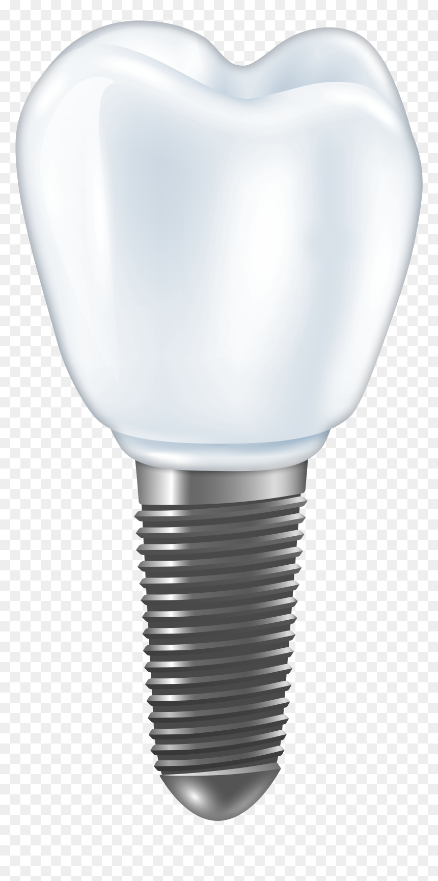 Dental Implant Png Clipart - Имплант Png, Transparent Png - street light clipart png