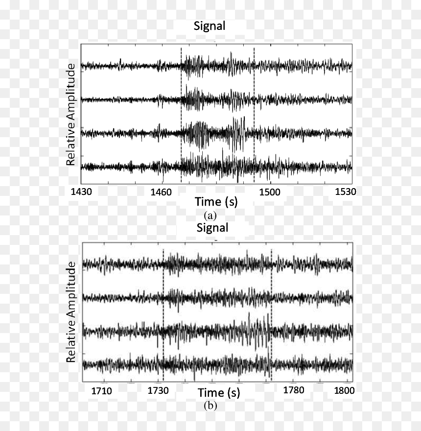 Epilepsy Seizure Example, HD Png Download - mit png