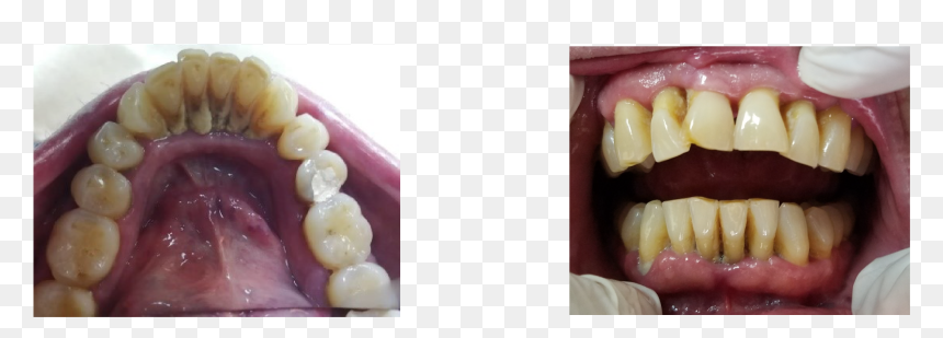 Dentistry, HD Png Download - humo de cigarro png