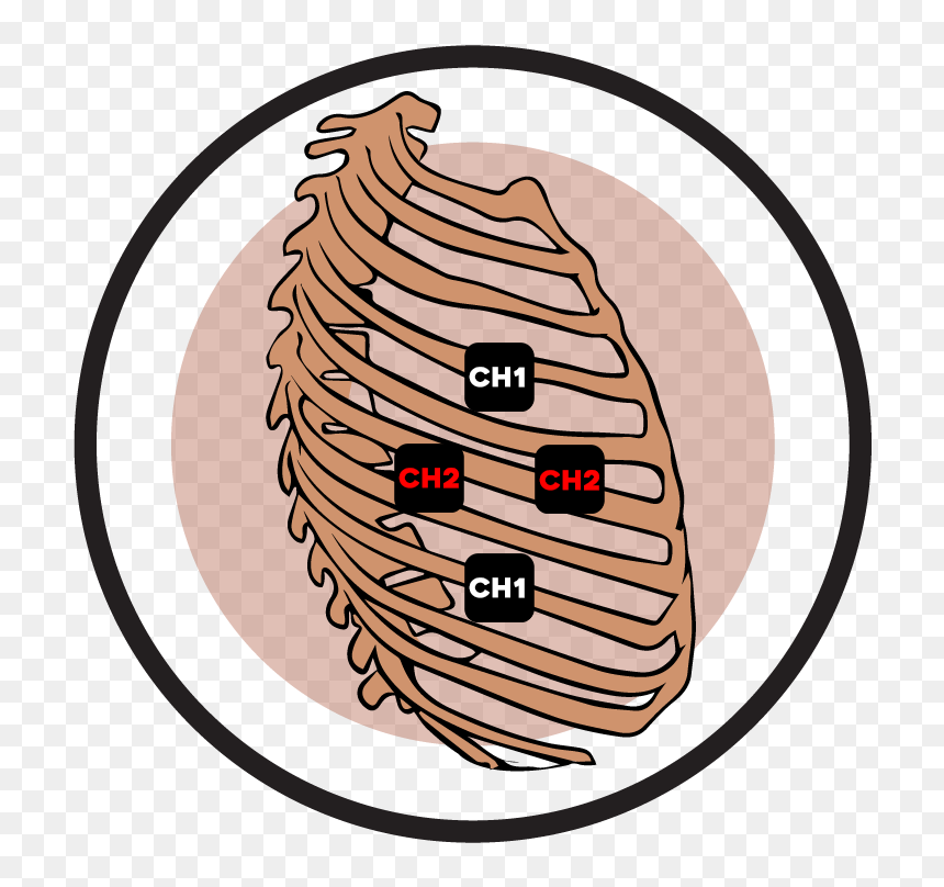Rib Cage Electrode Pad Placement - Transcutaneous Electrical Nerve Stimulation, HD Png Download - ribcage png