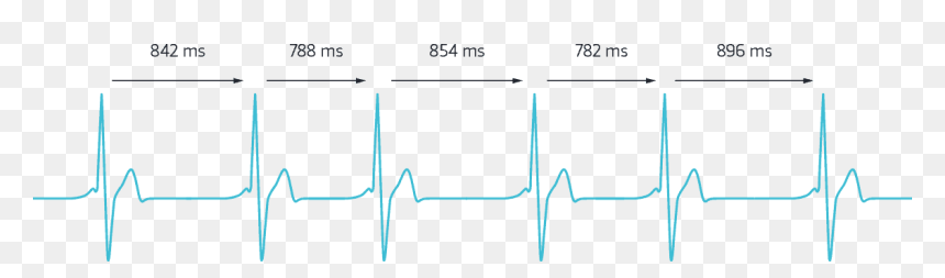 Heartbeat Rate Graph, HD Png Download - heartbeat png