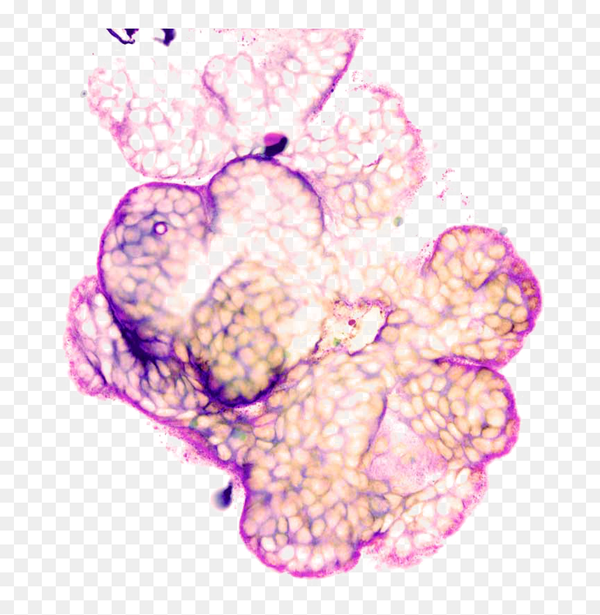 Illustration, HD Png Download - breast cancer butterfly png