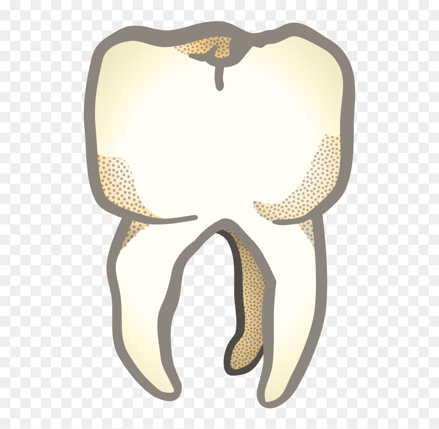 Zahn , Remix 245901 , Outline , Teaching , Tooth , - Illustration, HD Png Download - teeth grill png