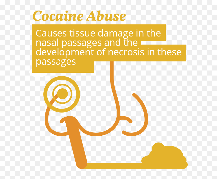 Cocaine Peptic Ulcer, HD Png Download - cocaine png