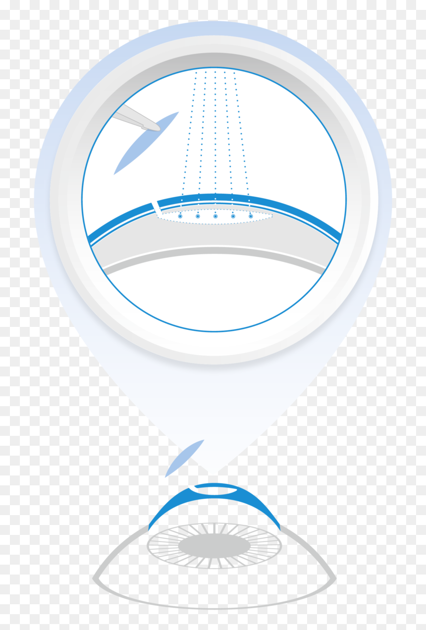 Difference Between Lasik Smile And Prk, HD Png Download - laser eyes png