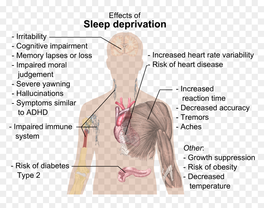 Effects Of Sleep Deprivation Diagram, HD Png Download - loss.png