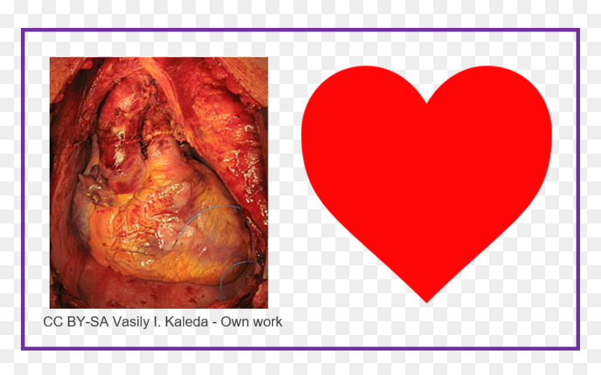 Does A Heart Look Like, HD Png Download - human heart png