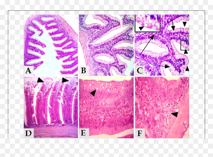 Illustration, HD Png Download - intestine png