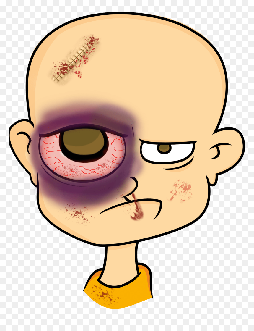 Eyebrow Clipart Eyelid - Cartoon With Black Eye, HD Png Download - eyelid png