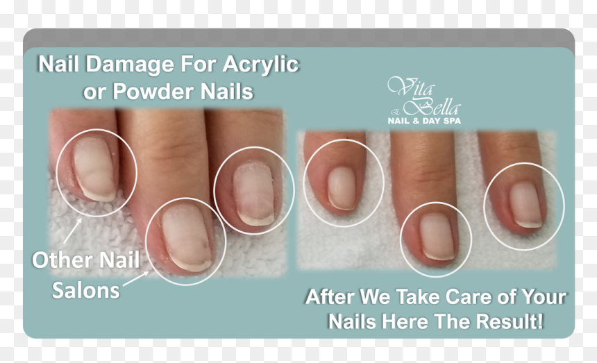 Picture - Nail Polish, HD Png Download - metal nail png