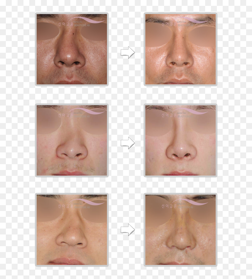 Bronze, HD Png Download - septum png