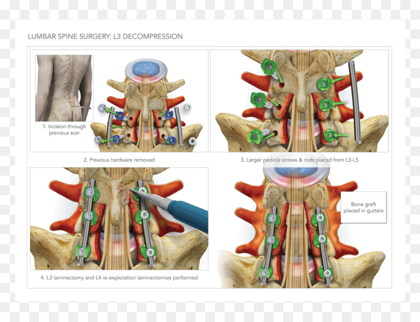 Rib, HD Png Download - spine png