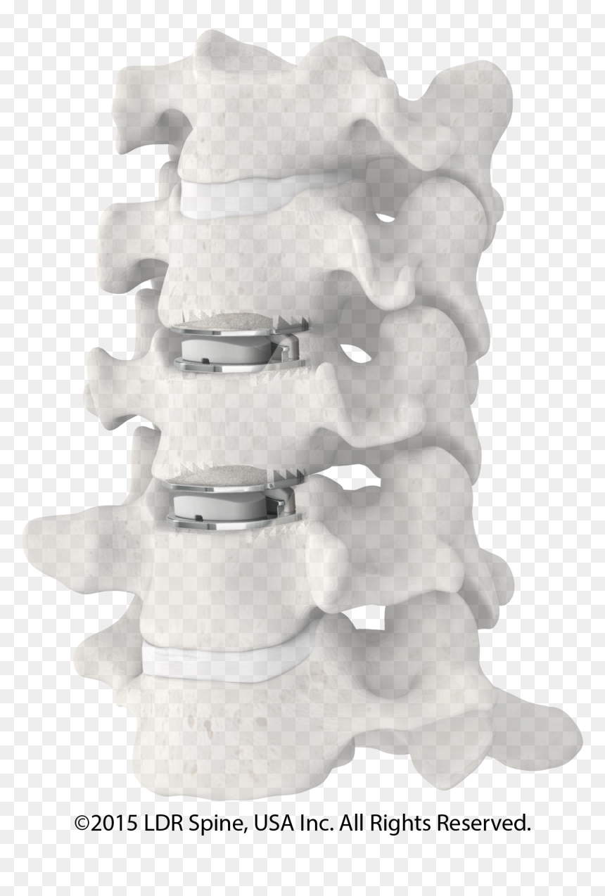 2 Discs In Spine Model - Mobi C Replacement Disc, HD Png Download - spine png