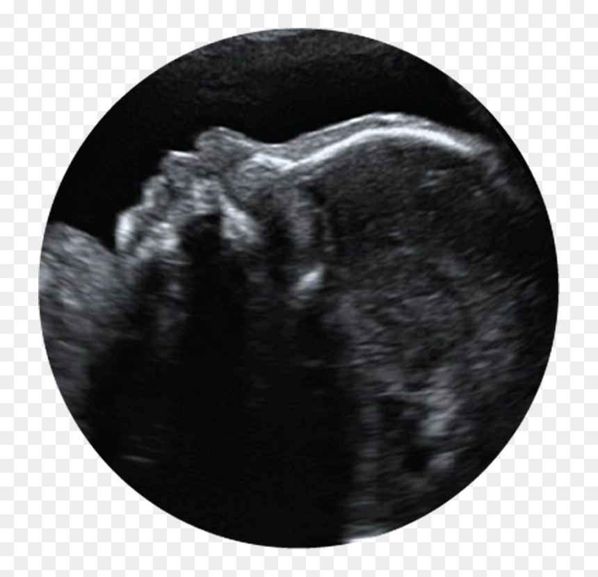Prenatal Ultrasound Clipart, HD Png Download - ultrasound png