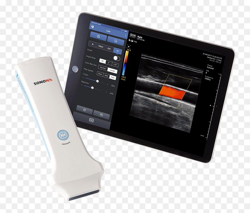 Picture - Healcerion Sonon 300l Price, HD Png Download - ultrasound png