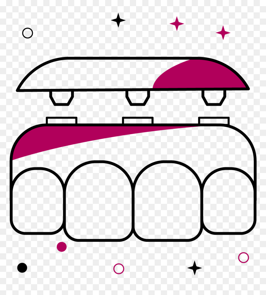 Implant Retained Dentures, HD Png Download - dentures png