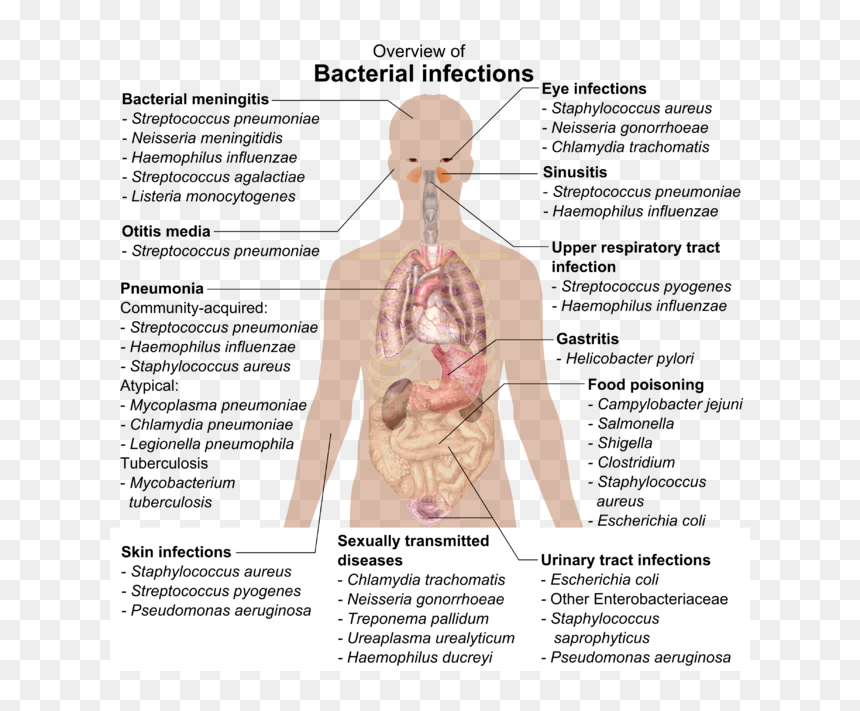 Overview Of Bacterial Infections, HD Png Download - bacteria png