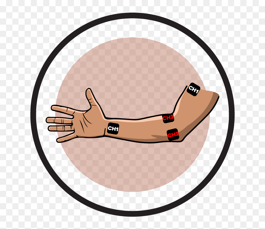 Arm Electrode Pad Placement - Transcutaneous Electrical Nerve Stimulation, HD Png Download - electrode png