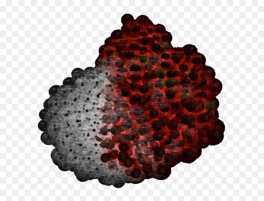 Craft, HD Png Download - tumor png