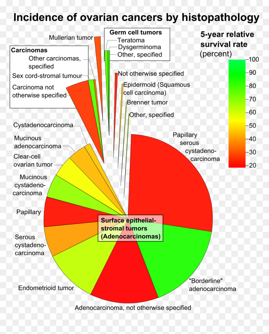 Incidence Of Ovarian Cancer By Histopathology, HD Png Download - tumor png