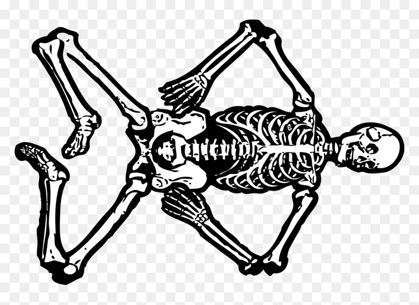 Jokes On Medical Students, HD Png Download - dead bodies png