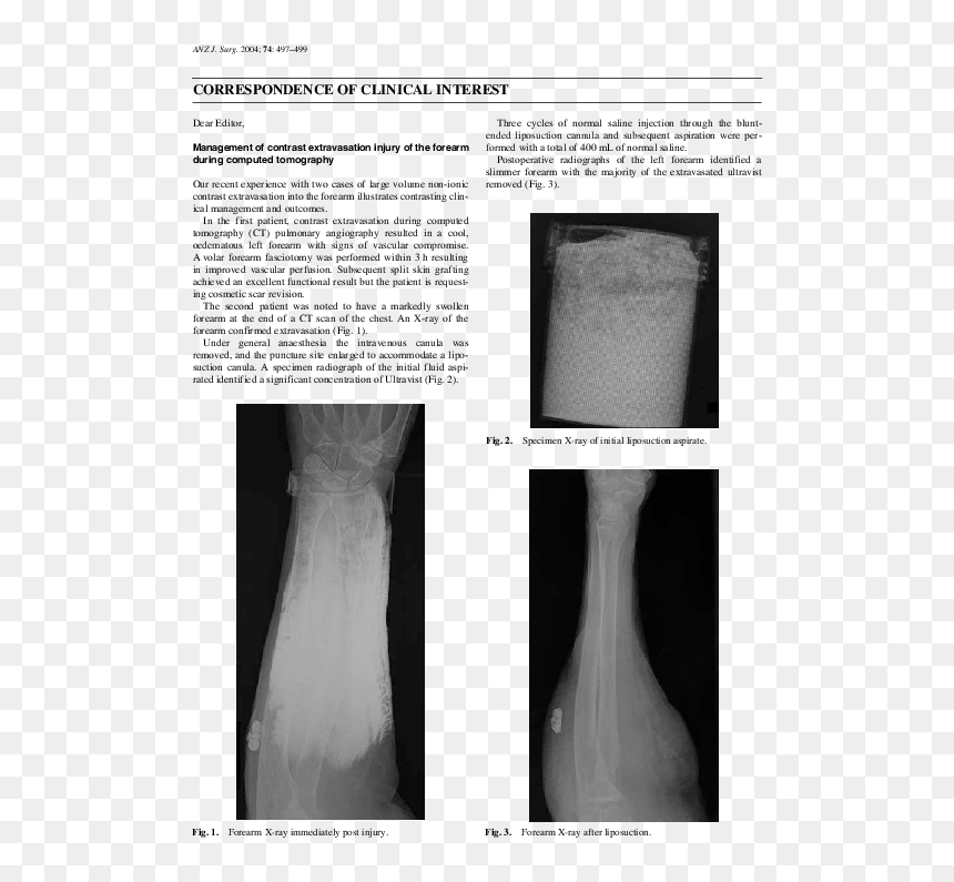 Medical Imaging, HD Png Download - forearm png
