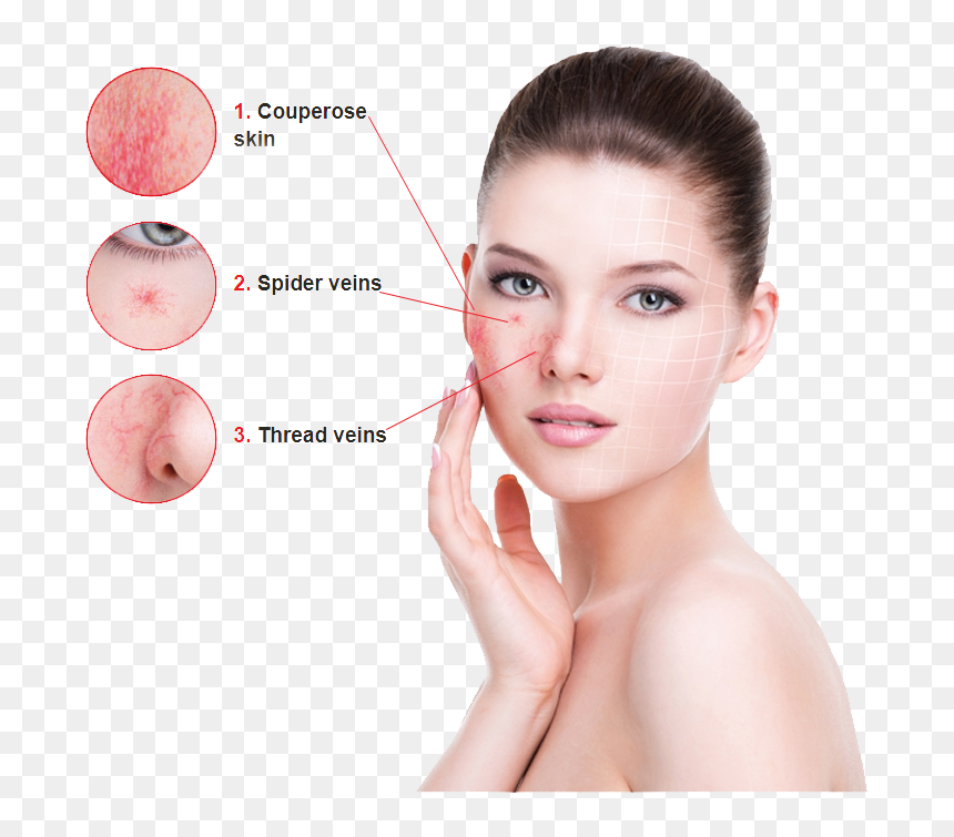 Skin, HD Png Download - eye veins png