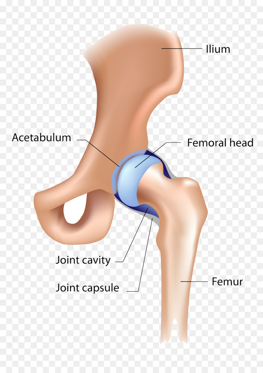 Posterior Wall Fracture Hip Dislocation, HD Png Download - femur png