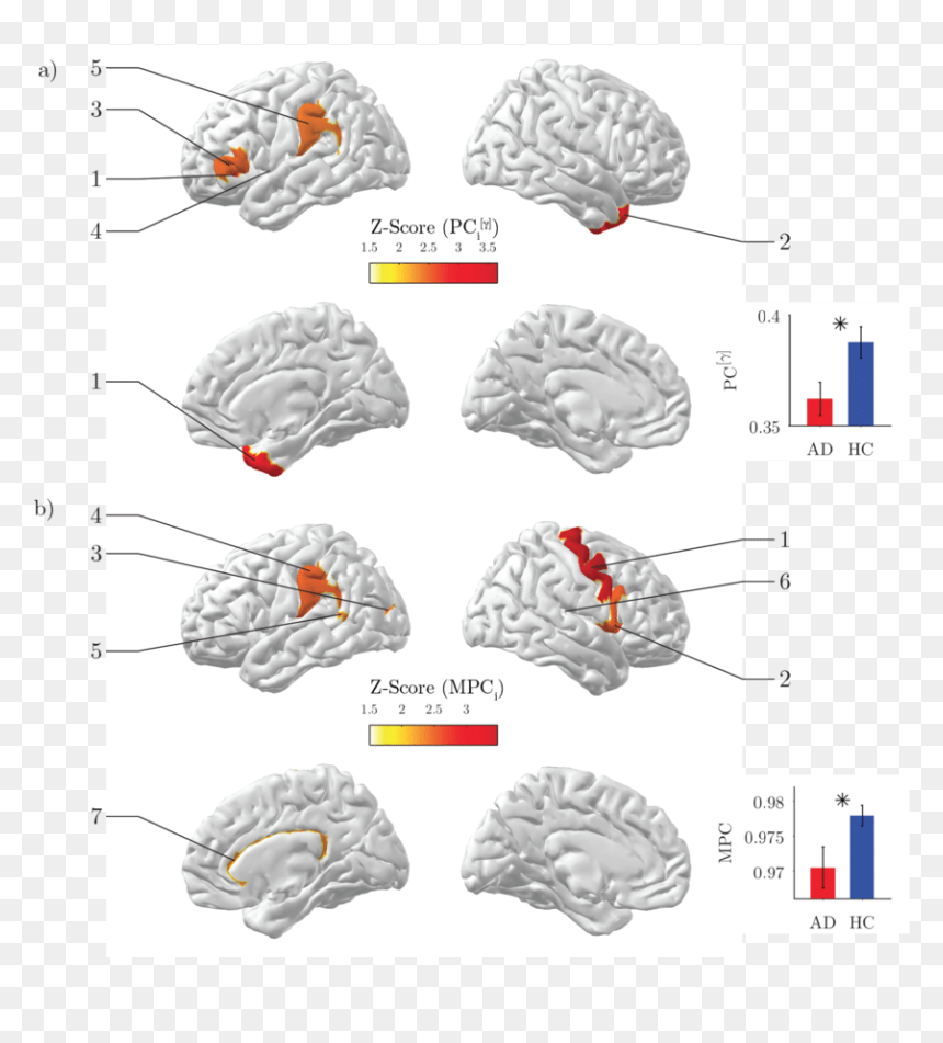 Diagram, HD Png Download - brain png