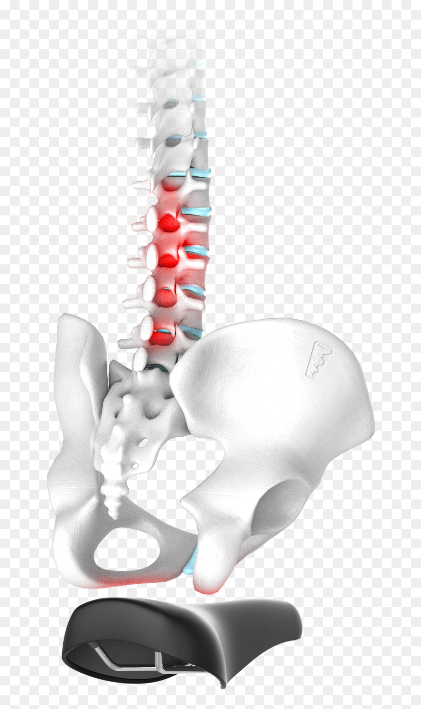 Spinal Disc Problems - X-ray, HD Png Download - back pain png