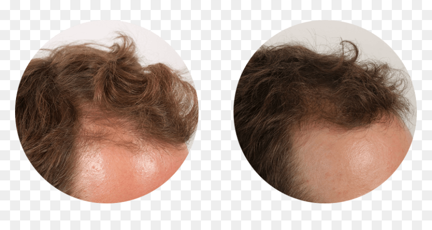 Lace Wig, HD Png Download - women's hair png