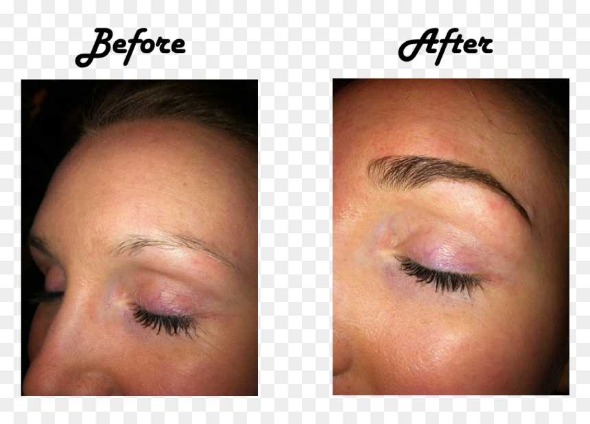 Prp Treatment For Eyebrows , Png Download, Transparent Png - eyebrows png