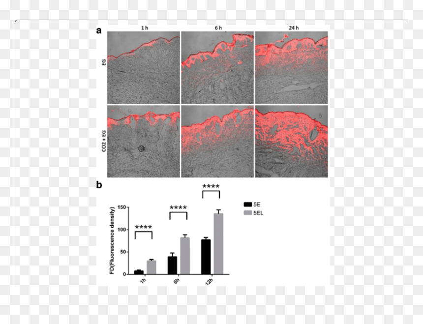Hypertrophic Scar In Vitro Model, HD Png Download - scars png