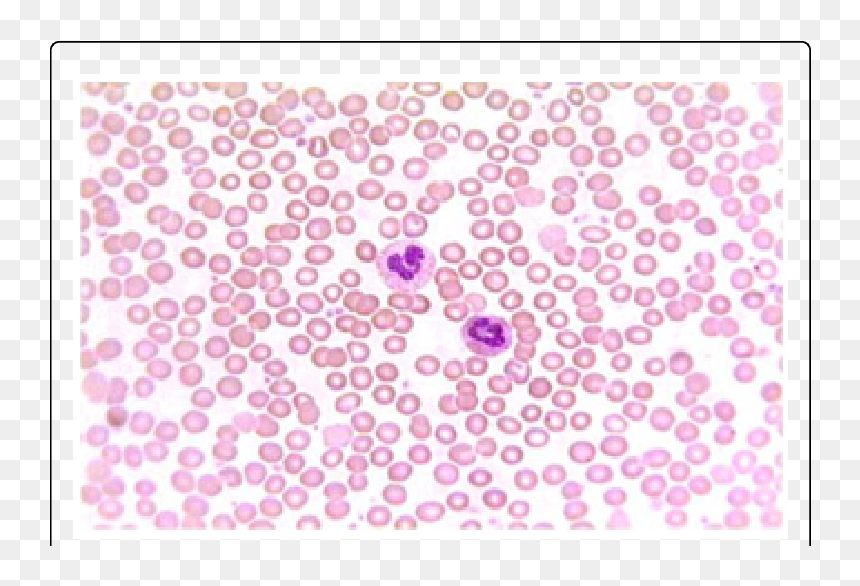 White Blood Cells, HD Png Download - blood smear png